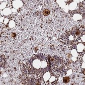 Anti-RGS18 antibody produced in rabbit Prestige Antibodies® Powered by Atlas Antibodies, affinity isolated antibody, buffered aqueous glycerol solution