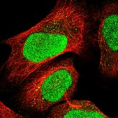 Anti-GTF2E2 antibody produced in rabbit Prestige Antibodies® Powered by Atlas Antibodies, affinity isolated antibody, buffered aqueous glycerol solution