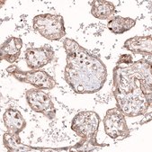 Monoclonal Anti-ROR2 antibody produced in mouse Prestige Antibodies® Powered by Atlas Antibodies, clone CL5950, purified immunoglobulin, buffered aqueous glycerol solution