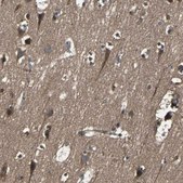 Anti-RAB7A antibody produced in rabbit Prestige Antibodies® Powered by Atlas Antibodies, affinity isolated antibody, buffered aqueous glycerol solution