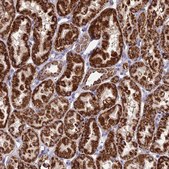 Anti-PSMD2 antibody produced in rabbit Prestige Antibodies® Powered by Atlas Antibodies, affinity isolated antibody, buffered aqueous glycerol solution