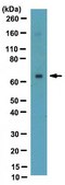 Anti-Estrogen Receptor α Antibody, clone F3-A ascites fluid, clone F3-A, from mouse