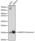 Anti-VAMP3/Cellubrevin Antibody, clone 2H8R8, Rabbit Monoclonal