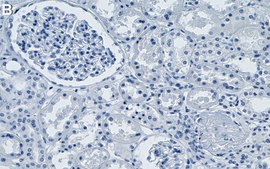 Anti-ZRSR2 Antibody, clone 1G16 ZooMAb® Rabbit Monoclonal recombinant, expressed in HEK 293 cells