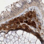 Anti-NAGK antibody produced in rabbit Prestige Antibodies® Powered by Atlas Antibodies, affinity isolated antibody, buffered aqueous glycerol solution