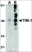 Anti-TIM-1 antibody produced in rabbit affinity isolated antibody, buffered aqueous solution