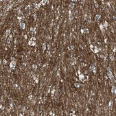 Anti-GPRC5B antibody produced in rabbit Prestige Antibodies® Powered by Atlas Antibodies, affinity isolated antibody, buffered aqueous glycerol solution