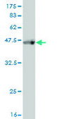 Monoclonal Anti-ABCF2 antibody produced in mouse clone 1D11, purified immunoglobulin, buffered aqueous solution