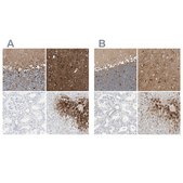 Anti-GLUL antibody produced in rabbit Ab1, Prestige Antibodies® Powered by Atlas Antibodies, affinity isolated antibody, buffered aqueous glycerol solution