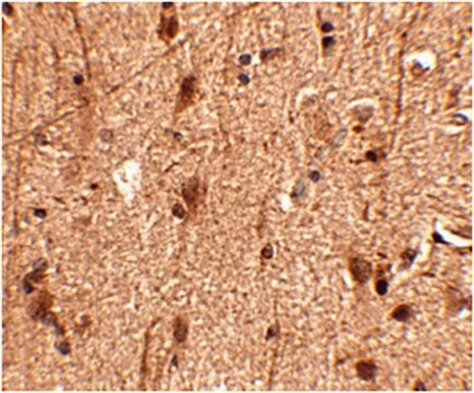 Anti-Slitrk3 Antibody from rabbit, purified by affinity chromatography