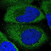 Anti-EIF5 antibody produced in rabbit Prestige Antibodies® Powered by Atlas Antibodies, affinity isolated antibody, buffered aqueous glycerol solution