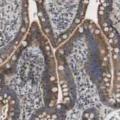 Anti-HADHA antibody produced in rabbit Prestige Antibodies® Powered by Atlas Antibodies, affinity isolated antibody, buffered aqueous glycerol solution