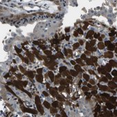 Anti-PDLIM1 antibody produced in rabbit Prestige Antibodies® Powered by Atlas Antibodies, affinity isolated antibody, buffered aqueous glycerol solution