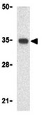 Anti-Tirap Antibody from rabbit, purified by affinity chromatography