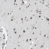 Anti-UBTF antibody produced in rabbit Prestige Antibodies® Powered by Atlas Antibodies, affinity isolated antibody, buffered aqueous glycerol solution