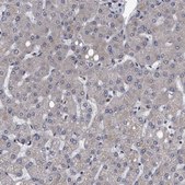 Anti-DTNBP1 antibody produced in rabbit Prestige Antibodies® Powered by Atlas Antibodies, affinity isolated antibody, buffered aqueous glycerol solution