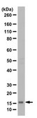 Anti-FHIT from rabbit, purified by affinity chromatography