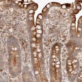 Anti-IL1R2 antibody produced in rabbit Prestige Antibodies® Powered by Atlas Antibodies, affinity isolated antibody, buffered aqueous glycerol solution, ab2