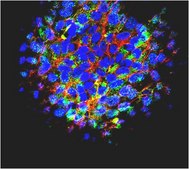 Anti-Podocalyxin-like protein I (Cytotoxic) Antibody, clone mAb 84 clone mab 84, from mouse