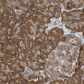Anti-VAPA antibody produced in rabbit Prestige Antibodies® Powered by Atlas Antibodies, affinity isolated antibody, buffered aqueous glycerol solution
