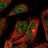 Anti-TSEN2 antibody produced in rabbit Prestige Antibodies® Powered by Atlas Antibodies, affinity isolated antibody, buffered aqueous glycerol solution, ab1