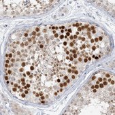 Anti-SCML1 antibody produced in rabbit Prestige Antibodies® Powered by Atlas Antibodies, affinity isolated antibody, buffered aqueous glycerol solution