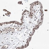 Anti-SNRNP200 antibody produced in rabbit Prestige Antibodies® Powered by Atlas Antibodies, affinity isolated antibody, buffered aqueous glycerol solution