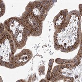 Anti-TJAP1 antibody produced in rabbit Prestige Antibodies® Powered by Atlas Antibodies, affinity isolated antibody, buffered aqueous glycerol solution
