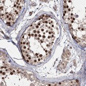 Anti-PRC1 antibody produced in rabbit Prestige Antibodies® Powered by Atlas Antibodies, affinity isolated antibody, buffered aqueous glycerol solution