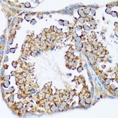 Anti-WAVE2/WASF2 Antibody, clone 7A6C10, Rabbit Monoclonal