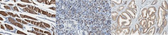 Anti-SKI2W Antibody, clone 8D10.2 clone 8D10.2, from mouse