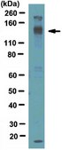 Anti-WASH complex subunit FAM21C Antibody from rabbit