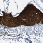Anti-SFN antibody produced in rabbit Prestige Antibodies® Powered by Atlas Antibodies, affinity isolated antibody, buffered aqueous glycerol solution