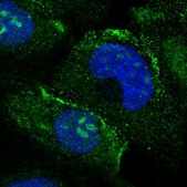 Anti-MAK16 antibody produced in rabbit Prestige Antibodies® Powered by Atlas Antibodies, affinity isolated antibody, buffered aqueous glycerol solution