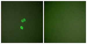 Anti-Galectin 3 antibody produced in rabbit affinity isolated antibody