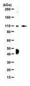 Anti-Dihydropyrimidine dehydrogenase/DPYD Antibody from rabbit, purified by affinity chromatography
