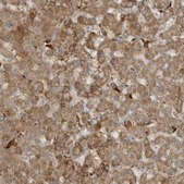 Anti-THG1L antibody produced in rabbit Prestige Antibodies® Powered by Atlas Antibodies, affinity isolated antibody, buffered aqueous glycerol solution