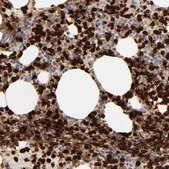 Anti-LCN2 antibody produced in rabbit Prestige Antibodies® Powered by Atlas Antibodies, affinity isolated antibody, buffered aqueous glycerol solution