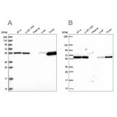 Anti-PRPF19 antibody produced in rabbit Prestige Antibodies® Powered by Atlas Antibodies, affinity isolated antibody, buffered aqueous glycerol solution