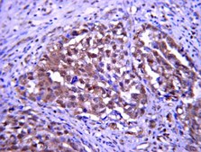 Anti-Pumilio-2 (PUM2) Antibody from rabbit, purified by affinity chromatography