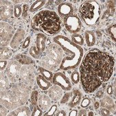 Anti-WASL antibody produced in rabbit Prestige Antibodies® Powered by Atlas Antibodies, affinity isolated antibody, buffered aqueous glycerol solution