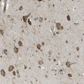 Anti-USP30 antibody produced in rabbit Prestige Antibodies® Powered by Atlas Antibodies, affinity isolated antibody, buffered aqueous glycerol solution