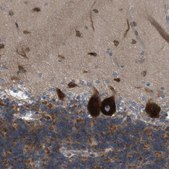 Anti-GJC3 antibody produced in rabbit Prestige Antibodies® Powered by Atlas Antibodies, affinity isolated antibody, buffered aqueous glycerol solution