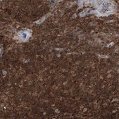 Anti-PSMB10 antibody produced in rabbit Prestige Antibodies® Powered by Atlas Antibodies, affinity isolated antibody, buffered aqueous glycerol solution