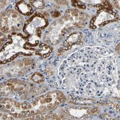 Anti-MTX1 antibody produced in rabbit Prestige Antibodies® Powered by Atlas Antibodies, affinity isolated antibody, buffered aqueous glycerol solution