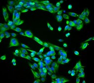 MCA205 Mouse Fibrosarcoma Cell Line MCA205 mouse fibrosarcoma cell line is an excellent model for studying immune response to tumor cells and the development of targeted cancer immunotherapies.