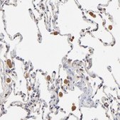 Anti-RNF213 antibody produced in rabbit Prestige Antibodies® Powered by Atlas Antibodies, affinity isolated antibody, buffered aqueous glycerol solution