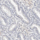 Anti-STK31 antibody produced in rabbit Prestige Antibodies® Powered by Atlas Antibodies, affinity isolated antibody, buffered aqueous glycerol solution