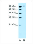 Anti-RHOBTB1 antibody produced in rabbit affinity isolated antibody