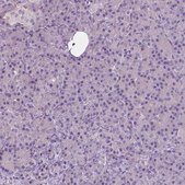 Anti-SERPINI1 antibody produced in rabbit Prestige Antibodies® Powered by Atlas Antibodies, affinity isolated antibody, buffered aqueous glycerol solution